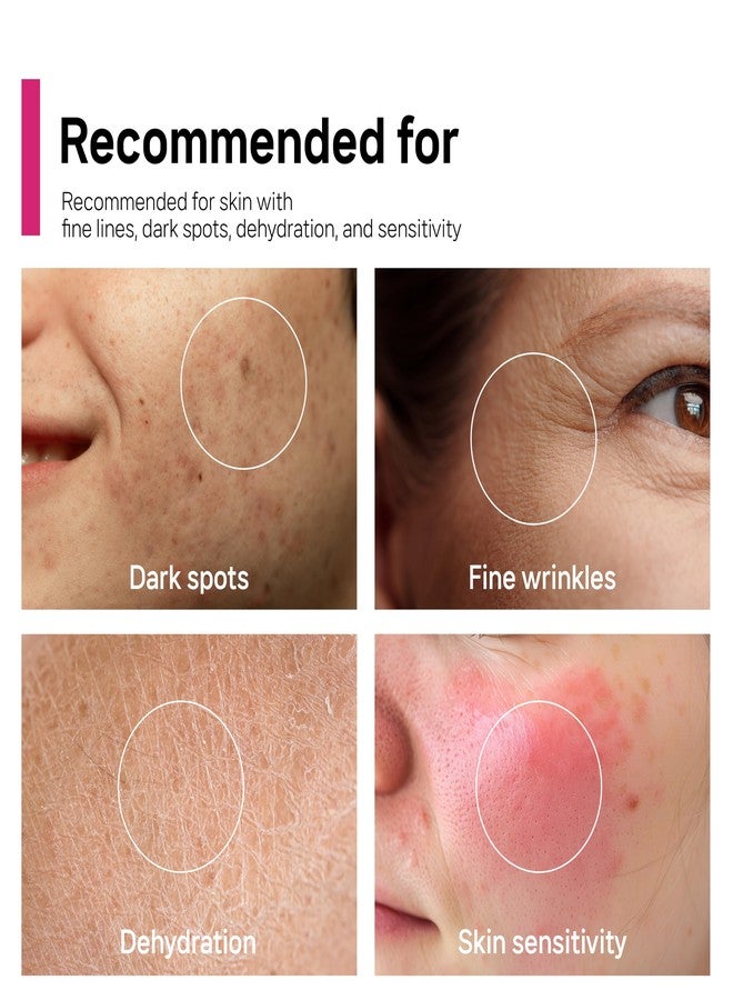 CELDYQUE Arbutin 7% + Tranexamic Acid 5% + Niacinamide 2% Intensive Tone Care Facial Cream -Dark Spots, Freckle, Blemishes, Pigmentation, Dull & Uneven-Looking Tone w/ Alpha Arbuitn 20,000 ppm Korean Skincare - Image 4